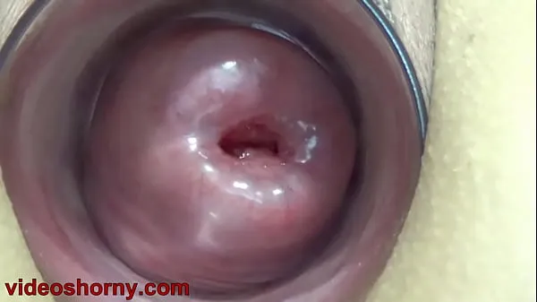 Big Uterus Penetration with Objects, Pumping Cervix Prolapse fresh Movies