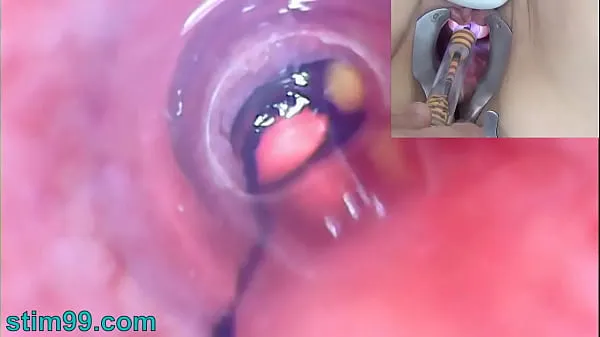 Big Mature Woman Peehole Endoscope Camera in Bladder with Balls fresh Movies