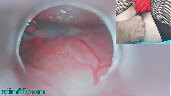 Big Uncensored Japanese Insemination with Cum into Uterus and Endoscope Camera by Cervix to watch inside womb fresh Movies